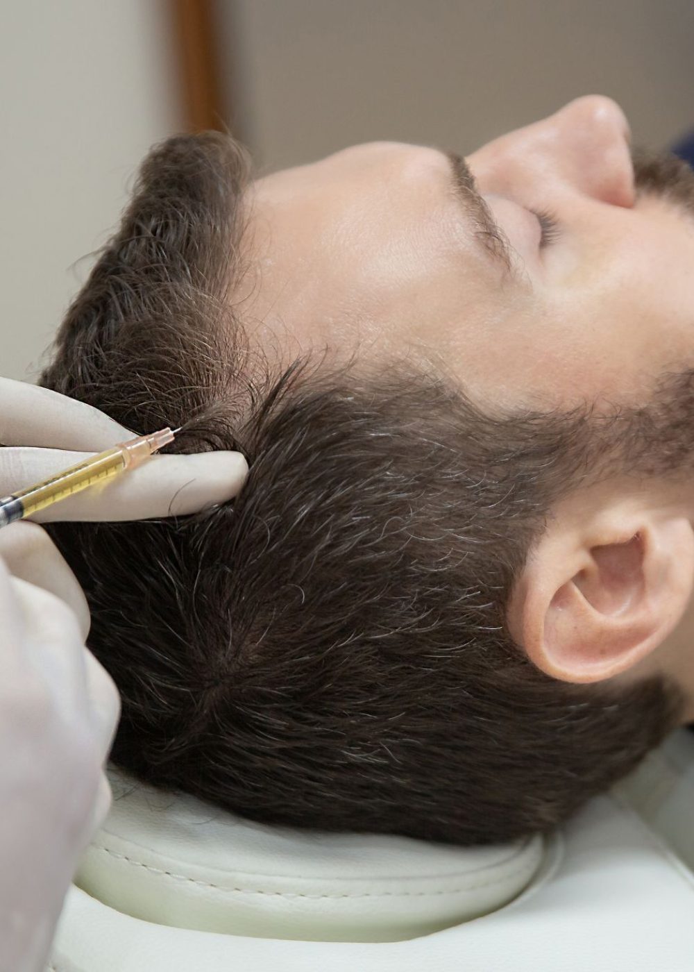 PRP - Tricologia